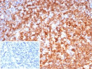 HLA-DRB1 Antibody