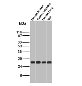HLA-DRB1 Antibody