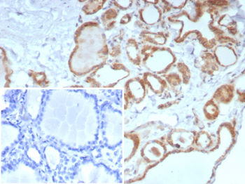 CALCA Antibody