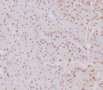 TFE3 Antibody