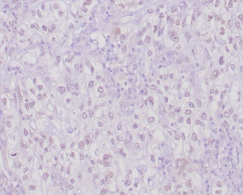 TFE3 Antibody