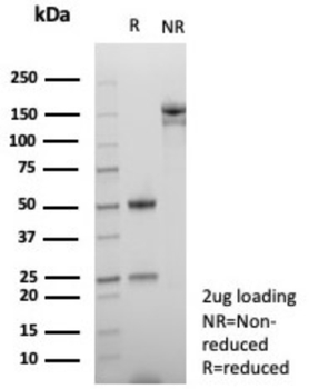 NUTM1 Antibody