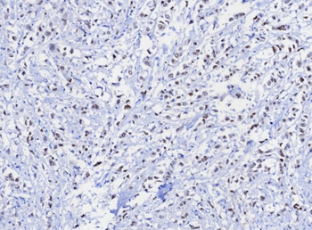 TRPS1 Antibody