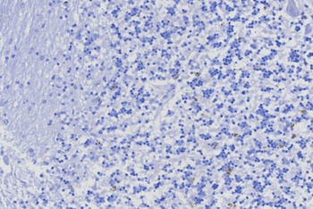 TRPS1 Antibody