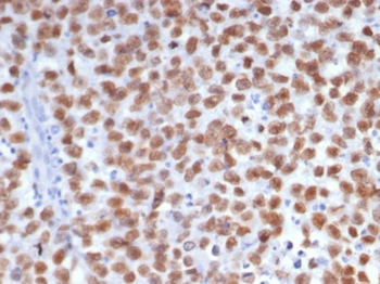 SALL4 Antibody