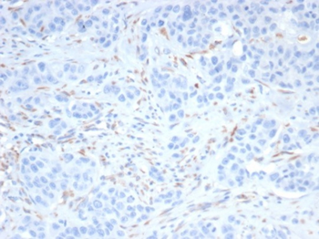SALL4 Antibody