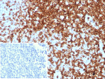 CD7 Antibody
