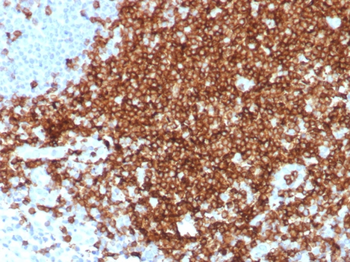 CD7 Antibody