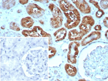 FABP3 Antibody