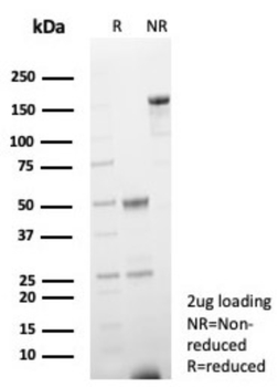 FABP3 Antibody