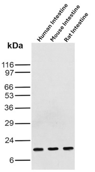 FABP3 Antibody