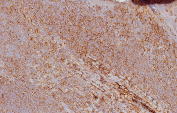 HLA-B Antibody