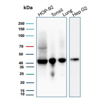 HLA-B Antibody