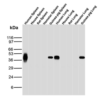 HLA-B Antibody
