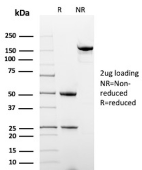 HLA-B Antibody