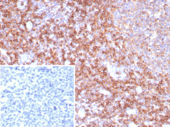 ENTPD1 Antibody