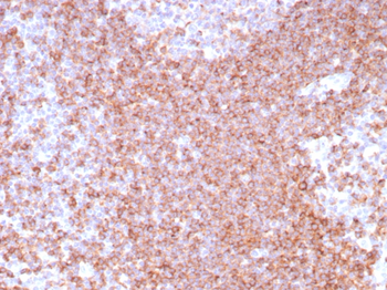 ENTPD1 Antibody