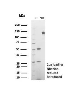 ENTPD1 Antibody