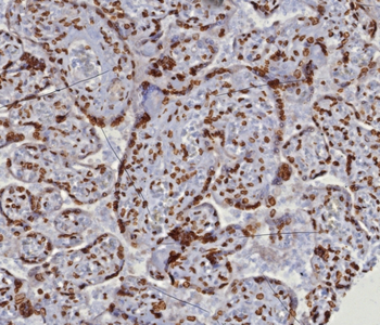 Recombinant Double Stranded DNA (dsDNA) (Nuclear Marker) Antibody