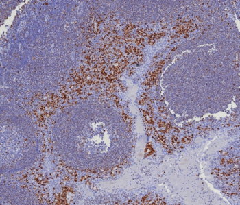 IRF4 Antibody