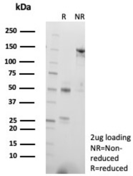 B3GAT1 Antibody