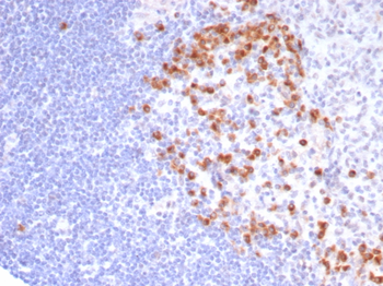 B3GAT1 Antibody