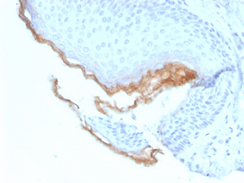 KLK5 Antibody