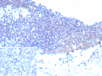 IL2RA Antibody