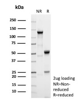 IL2RA Antibody