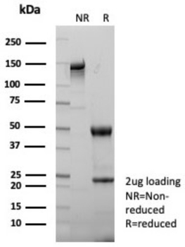 TGFB1 Antibody