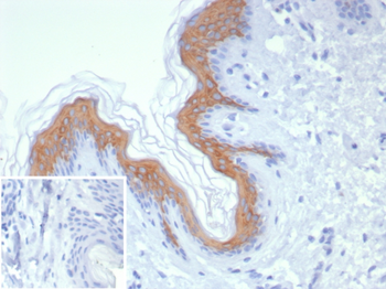 KRT1 Antibody