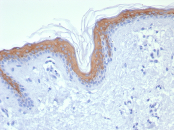 KRT1 Antibody