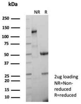 KRT1 Antibody