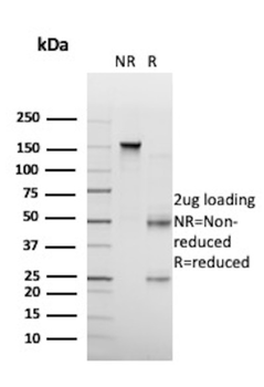 DSG1 Antibody