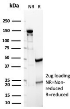 CA9 Antibody