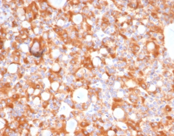 CA9 Antibody