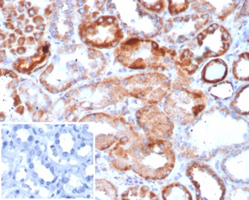 CA9 Antibody