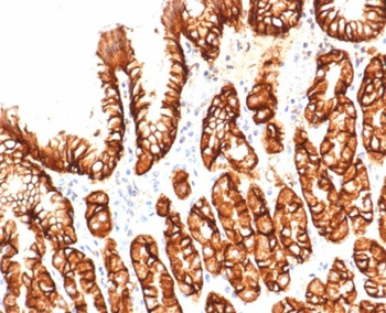 CA9 Antibody