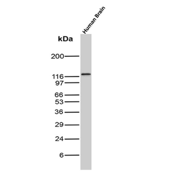 MDM2 Antibody