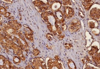 KRT77 Antibody