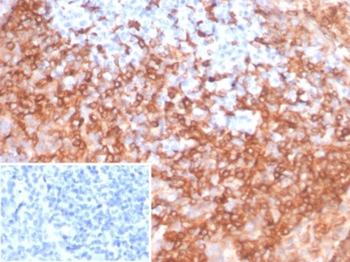 HLA-DRB1 Antibody