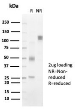 HLA-DRB1 Antibody