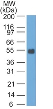 EPCAM Antibody
