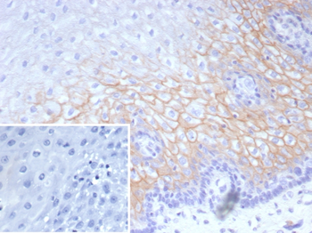 DSC2 Antibody