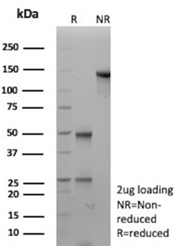 DSC2 Antibody