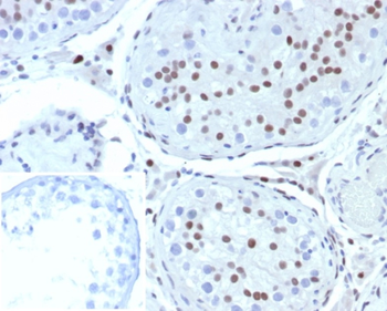 NR5A1 Antibody