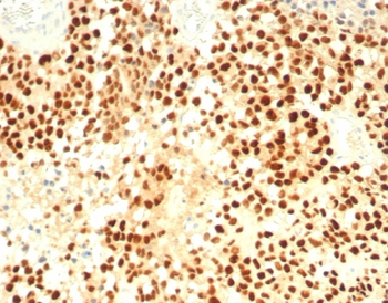 NR5A1 Antibody