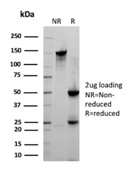 NR5A1 Antibody