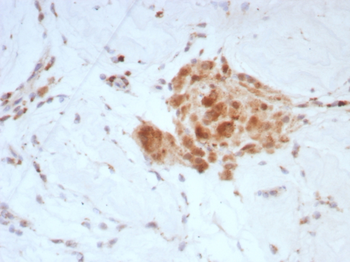 SHBG Antibody