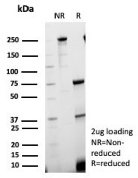 SHBG Antibody